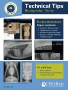 Technical Tips Throax Poster Preview